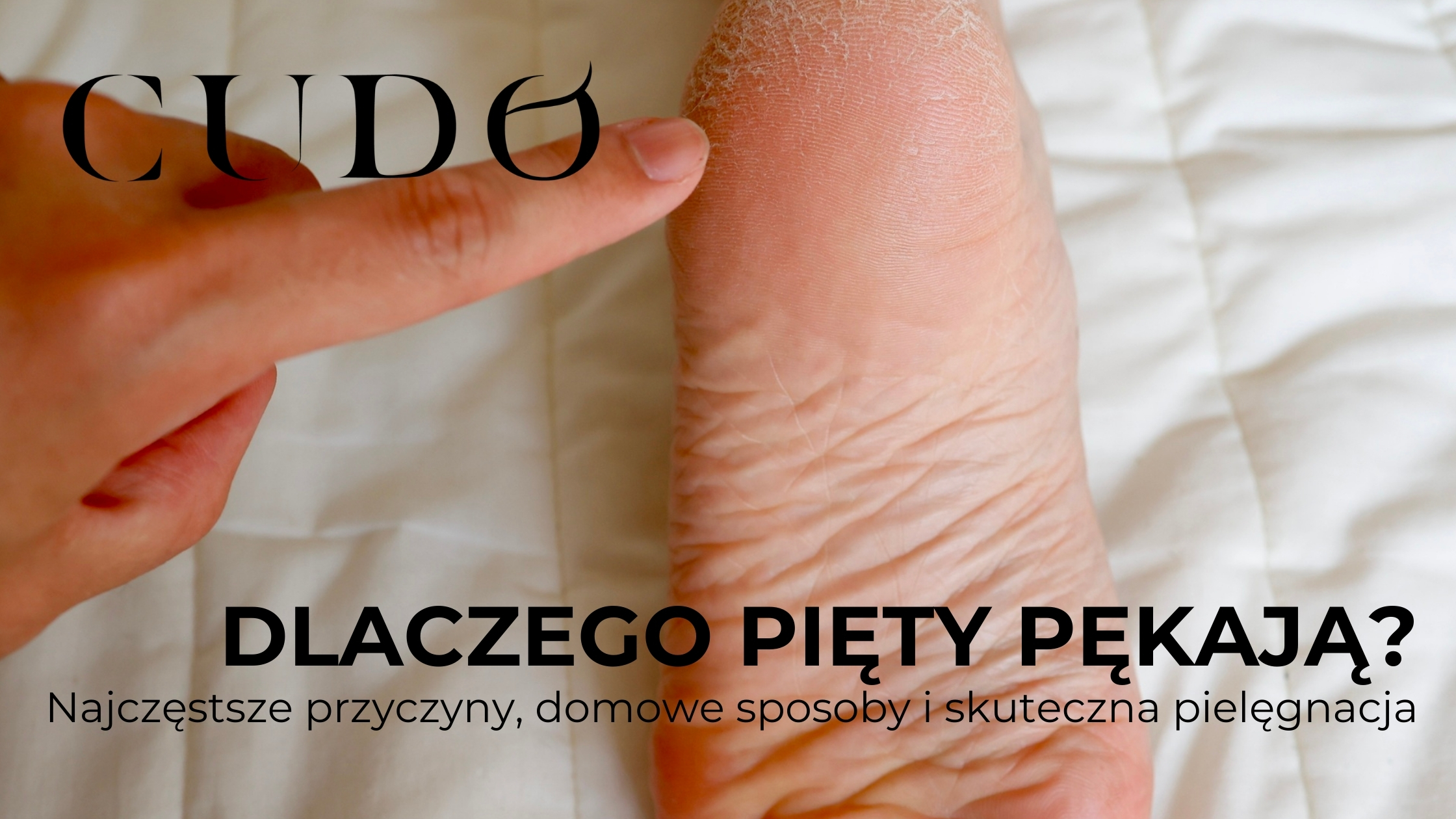 Dlaczego pięty pękają? Najczęstsze przyczyny, domowe sposoby i skuteczna pielęgnacja